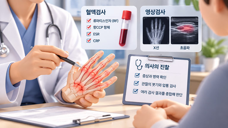 류마티스 관절염 확인을 위한 혈액검사와 영상검사 및 의사 진찰